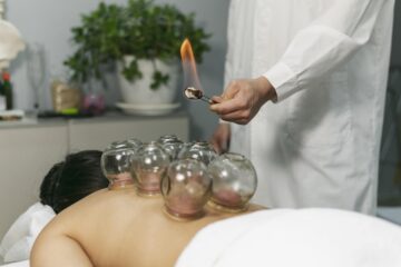 Cupping Therapy